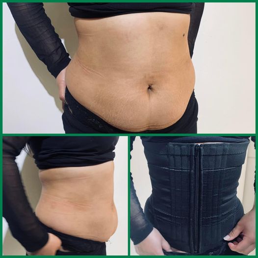 449613750_872030511634255_7787429978383585802_n